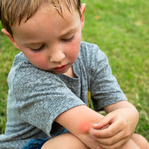 Young boy looking at a mosquito bite on his elbow