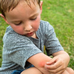 Child looking at a mosquito bite on his arm
